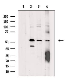 Invitrogen ZNF71 Polyclonal Antibody 100 &mu;L; Unconjugated:Antibodies,