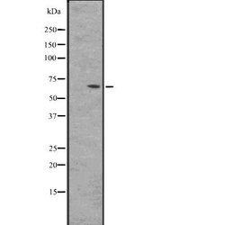 Invitrogen BIN2 Polyclonal Antibody 100 &mu;L | Buy Online | Invitrogen&trade; | Fisher Scientific