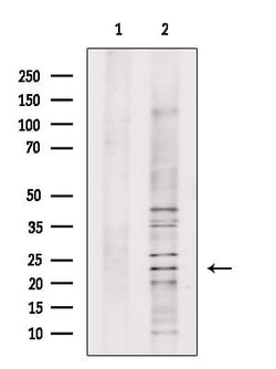 Invitrogen WARS2 Polyclonal Antibody 100 &mu;L; Unconjugated:Antibodies,