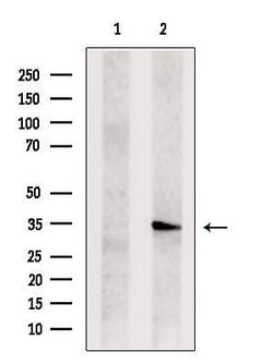 Invitrogen TSSC4 Polyclonal Antibody 100 &mu;L | Buy Online | Invitrogen&trade; | Fisher Scientific
