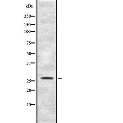 Invitrogen FGFBP1 Polyclonal Antibody 100 &mu;L | Buy Online | Invitrogen&trade; | Fisher Scientific