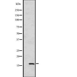 Invitrogen HSPB9 Polyclonal Antibody 100 &mu;L; Unconjugated:Antibodies,
