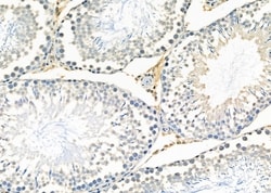 Invitrogen IGFBPL1 Polyclonal Antibody 100 &mu;L; Unconjugated:Antibodies,