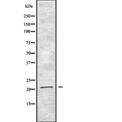 Invitrogen Interferon alpha-2 Polyclonal Antibody 100 &mu;L; Unconjugated:Antibodies,