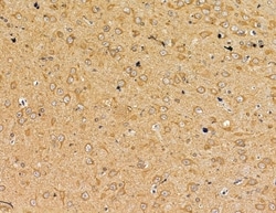 Invitrogen Interferon alpha-4/10/14 Polyclonal Antibody 100 &mu;L; Unconjugated:Antibodies,