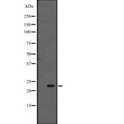 Invitrogen Interferon alpha-4/10/14 Polyclonal Antibody 100 &mu;L; Unconjugated:Antibodies,