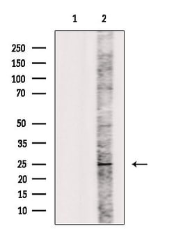 Invitrogen IL1F6 Polyclonal Antibody 100 &mu;L; Unconjugated:Antibodies,