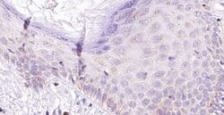Invitrogen IL1F10 Polyclonal Antibody 100 &mu;L; Unconjugated:Antibodies,