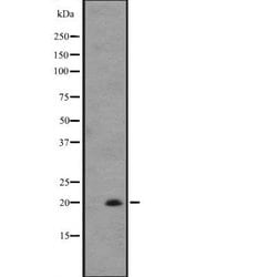 Invitrogen IL-25 Polyclonal Antibody 100 &mu;L; Unconjugated:Antibodies,