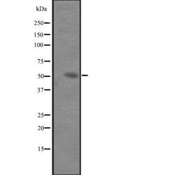 Invitrogen IL-6 Receptor Polyclonal Antibody 100 μL; Unconjugated:Antibodies,