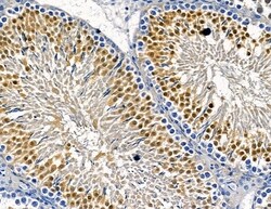 Invitrogen IFI35 Polyclonal Antibody 100 &mu;L; Unconjugated:Antibodies,