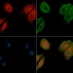 Invitrogen CD49a Polyclonal Antibody 100 &mu;L; Unconjugated:Antibodies,