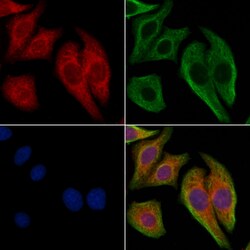 Invitrogen CD49a Polyclonal Antibody 100 &mu;L; Unconjugated:Antibodies,