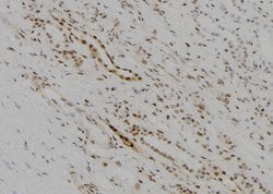 Invitrogen KDM5D Polyclonal Antibody 100 &mu;L; Unconjugated:Antibodies,