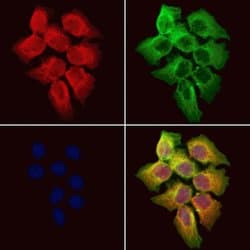 Invitrogen Cytokeratin 36 Polyclonal Antibody 100 &mu;L; Unconjugated:Antibodies,