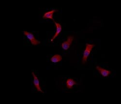 Invitrogen Cytokeratin 36 Polyclonal Antibody 100 &mu;L; Unconjugated:Antibodies,