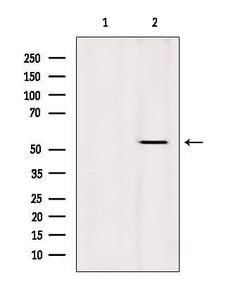 Invitrogen Cytokeratin 36 Polyclonal Antibody 100 &mu;L; Unconjugated:Antibodies,