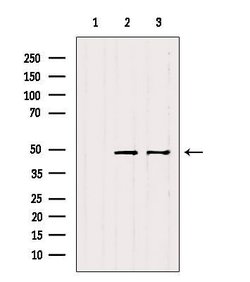 Invitrogen Cytokeratin 31/33A/33B Polyclonal Antibody 100 &mu;L; Unconjugated:Antibodies,