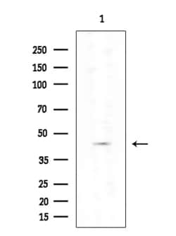 Invitrogen Cytokeratin 85/86 Polyclonal Antibody 100 &mu;L; Unconjugated:Antibodies,