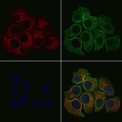 PLCE1 Polyclonal Antibody, Invitrogen 100 &mu;L; Unconjugated:Antibodies,