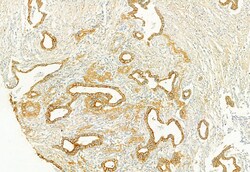 PLCE1 Polyclonal Antibody, Invitrogen 100 &mu;L; Unconjugated:Antibodies,