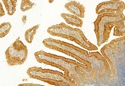 PLCE1 Polyclonal Antibody, Invitrogen 100 &mu;L; Unconjugated:Antibodies,