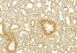 PLCE1 Polyclonal Antibody, Invitrogen 100 &mu;L; Unconjugated:Antibodies,