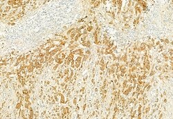 PLCE1 Polyclonal Antibody, Invitrogen 100 &mu;L; Unconjugated:Antibodies,