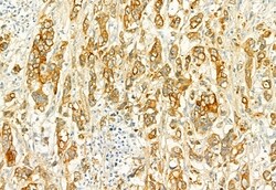 PLCE1 Polyclonal Antibody, Invitrogen 100 &mu;L; Unconjugated:Antibodies,