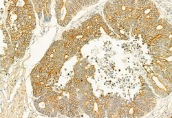 PLCE1 Polyclonal Antibody, Invitrogen 100 &mu;L; Unconjugated:Antibodies,