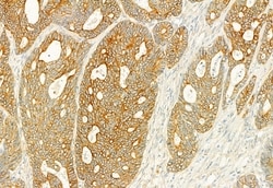 PLCE1 Polyclonal Antibody, Invitrogen 100 &mu;L; Unconjugated:Antibodies,