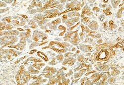PLCE1 Polyclonal Antibody, Invitrogen 100 &mu;L; Unconjugated:Antibodies,