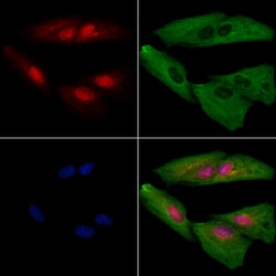 Invitrogen SAP130 Polyclonal Antibody 100 &mu;L; Unconjugated:Antibodies,