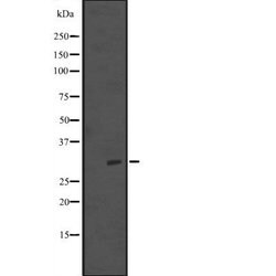 Invitrogen NSA2 Polyclonal Antibody 100 &mu;L; Unconjugated:Antibodies,