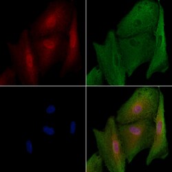Invitrogen KIF23 Polyclonal Antibody 100 &mu;L; Unconjugated:Antibodies,