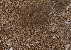 Invitrogen KIF23 Polyclonal Antibody 100 &mu;L; Unconjugated:Antibodies,