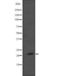 Invitrogen KappaB ras2 Polyclonal Antibody 100 &mu;L; Unconjugated:Antibodies,