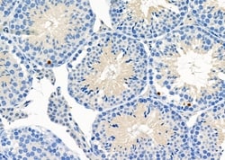 Invitrogen ALKBH5 Polyclonal Antibody 100 &mu;L; Unconjugated:Antibodies,