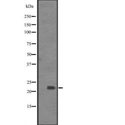 Invitrogen BCL7C Polyclonal Antibody 100 &mu;L; Unconjugated:Antibodies,