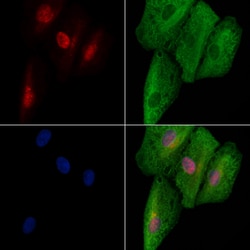 Invitrogen E2F8 Polyclonal Antibody 100 &mu;L; Unconjugated:Antibodies,