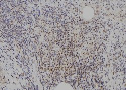 Invitrogen E2F8 Polyclonal Antibody 100 &mu;L; Unconjugated:Antibodies,