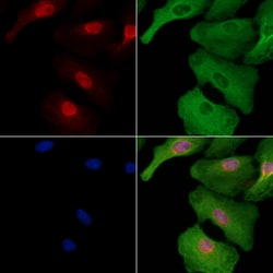 Invitrogen KLF14 Polyclonal Antibody 100 &mu;L; Unconjugated:Antibodies,