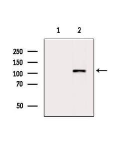 Invitrogen SMARCAD1 Polyclonal Antibody 100 &mu;L; Unconjugated:Antibodies,