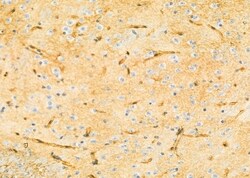 Invitrogen ZDHHC13 Polyclonal Antibody 100 &mu;L; Unconjugated:Antibodies,