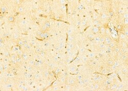 Invitrogen ZDHHC13 Polyclonal Antibody 100 &mu;L; Unconjugated:Antibodies,