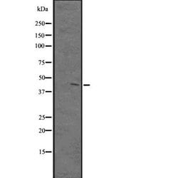 Invitrogen PKNOX1 Polyclonal Antibody 100 &mu;L; Unconjugated:Antibodies,