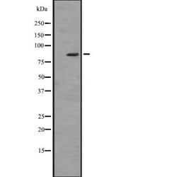 Invitrogen ZBTB16 Polyclonal Antibody 100 &mu;L; Unconjugated:Antibodies,