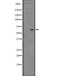 Invitrogen CYP4F12 Polyclonal Antibody 100 &mu;L; Unconjugated:Antibodies,