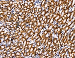 Invitrogen PI3K p55 gamma Polyclonal Antibody 100 &mu;L; Unconjugated:Antibodies,