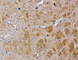 Invitrogen PI3K p55 gamma Polyclonal Antibody 100 &mu;L; Unconjugated:Antibodies,